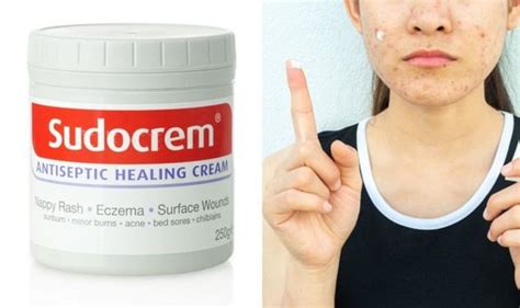  Do not use powder, baby wipes, adult bath products or medicines on their genital area. . Can i use sudocrem for fissure
